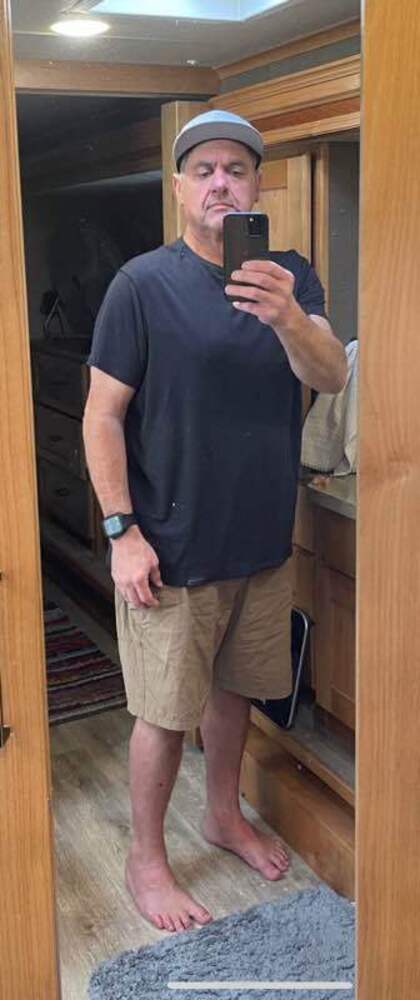 Frank before | weight loss against all odds