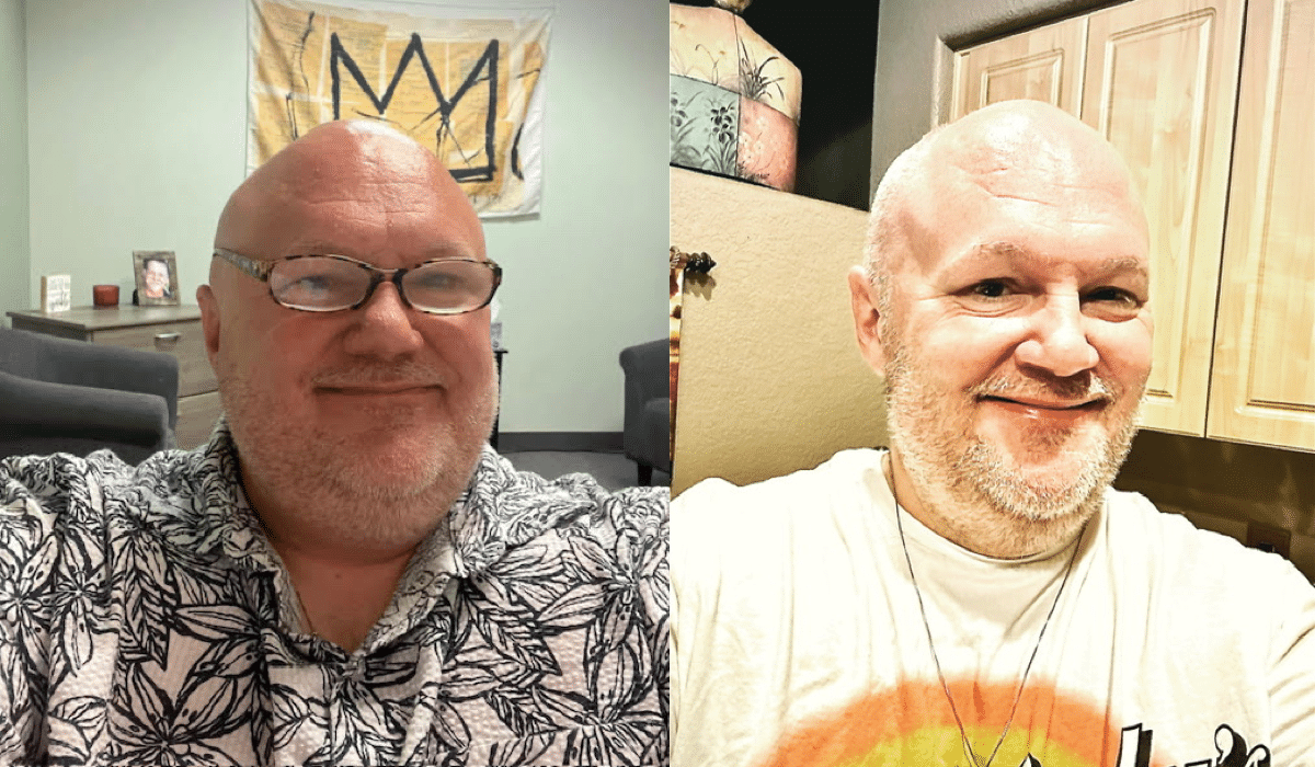 Patrick before and after